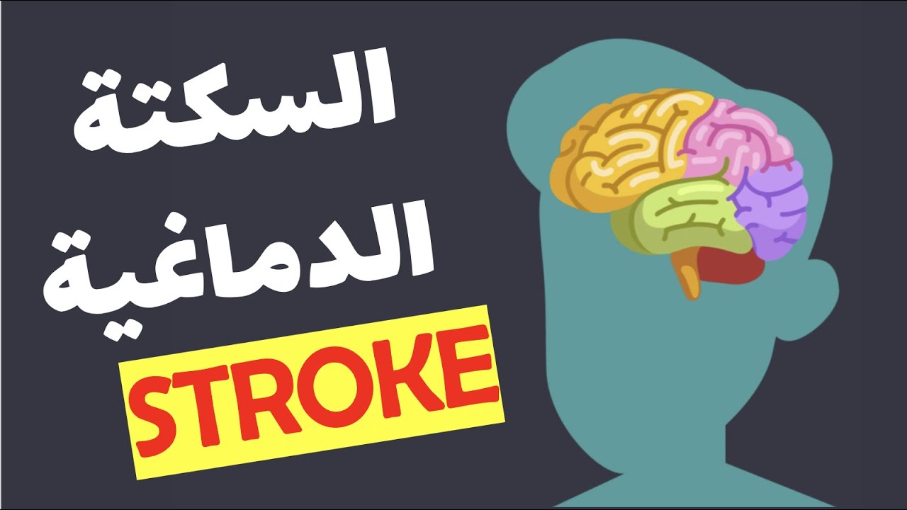 السكتة الدماغية